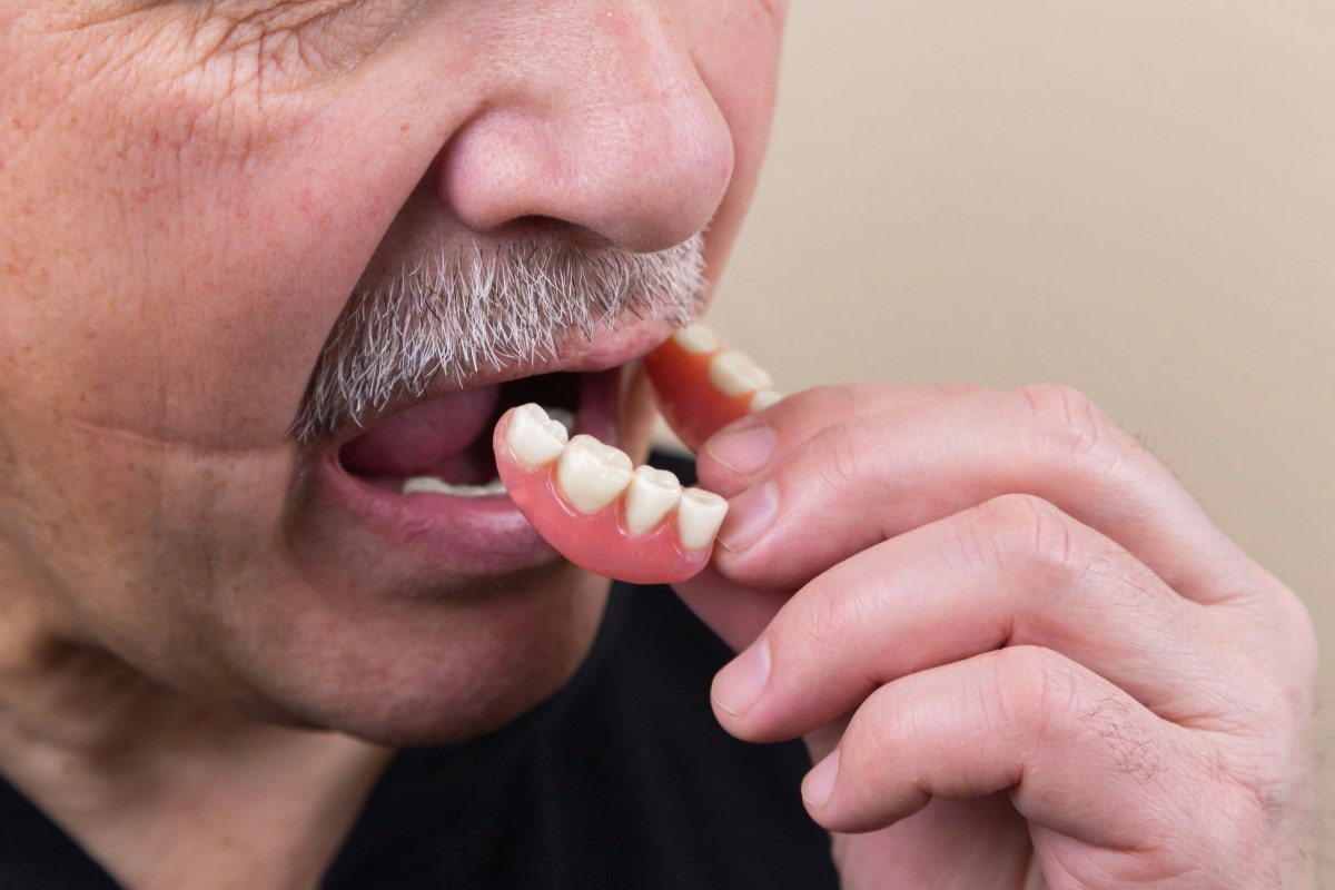 sognare-dentiera